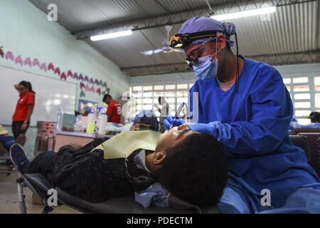 U.S. Air Force Master Sgt. Emeriles Curry, 346th Expeditionary Medical Operations Squadron dental hygienist, provides dental care to a local man May 16, 2018 in the Coclé Province of Panama. So far, in 2-weeks’ worth of Medical Readiness Training Exercises the teams, working in conjunction with the Panamanian Ministry of Health, have seen nearly 4,700 patients and 502 animals. The medical team is participating in Exercise New Horizons 2018, which is a joint training exercise focused on civil engineer, medical, and support service personnel’s ability to prepare, deploy, operate and redeploy out Stock Photo