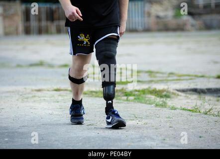 Disabled runner with an artificial leg walking. Trials among Ukrainian soldiers to the 43 rd US Marine Corps marathon. July 20, 2018. Kiev, Ukraine Stock Photo