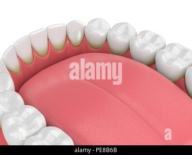 3d render of teeth with plaque and tartar over white background Stock Photo