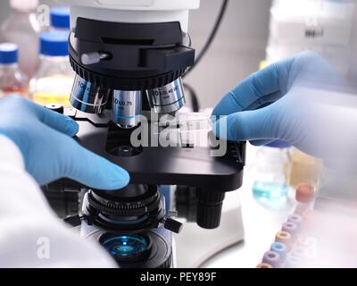 Close-up of a scientist placing a slide containing a human sample under a light microscope for medical testing. Stock Photo