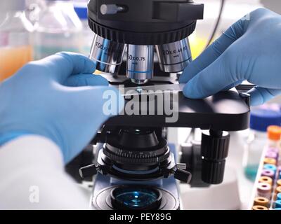 Close-up of a scientist placing a slide containing a human sample under a light microscope for medical testing. Stock Photo