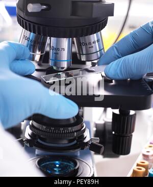 Close-up of a scientist placing a slide containing a human sample under a light microscope for medical testing. Stock Photo