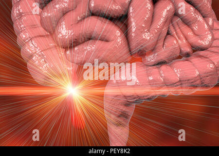 Appendicitis, conceptual illustration Stock Photo - Alamy