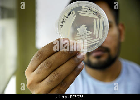 Bacterial colonies Stock Photo