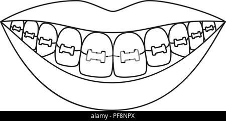 Line art black and white healthy smile in braces Stock Vector