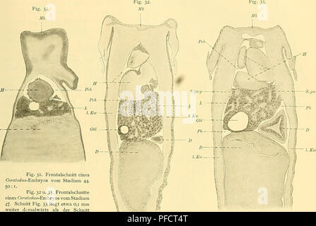 This paper explores the development of mesenteries, liver ligaments ...