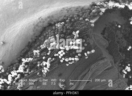 Morphologic ultrastructure of pollen granules found on a yellow 'Fireworks' sundrops, Oenothera fruticosa flower, revealed in the 99x magnified scanning electron microscopic (SEM) image, 2006. Image courtesy Centers for Disease Control (CDC) / Janice Haney Carr, Betsy Crane. () Stock Photo