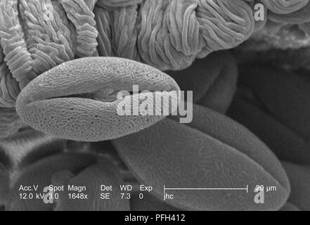 Morphologic ultrastructure of pollen grains found on a yellow 'Fireworks' sundrops, Oenothera fruticosa flower, revealed in the 1648x magnified scanning electron microscopic (SEM) image, 2006. Image courtesy Centers for Disease Control (CDC) / Janice Haney Carr, Betsy Crane. () Stock Photo