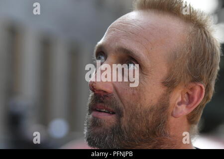 Czech lorry driver Martin Kucera, who survived the motorway bridge collapse in Genoa, Italy, last week, suffering three broken ribs, wants to return to his profession as soon as he recovers, he told reporters after his release from Prague's Thomayer hospital today, on Wednesday, August 22, 2018. He said at the press conference that he had survived the tragic accident thanks to a number of lucky coincidences. His lorry plunged 45 metres to the ground from the bustling Morandi motorway bridge after its part collapsed in north Italy last Tuesday. A total of 43 people died in the accident. (CTK Ph Stock Photo