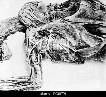 . The anatomy of the domestic fowl . Domestic animals; Veterinary medicine; Poultry. 236 ANATOMY or THE DOMESTIC FOWL receives blood from the vena supra-palatina and from the lower jaw bone and the external mandibular vein. It also receives blood from the external sublingual vein, and the subhngual gland. It follows the inner rini of the jaw bone. The maxillary vein receives an anastomosing branch from the cutaneous facial vein, at a point near the commissure of the mouth.. Fig. 73.—Photograph of blood-vessels and nerves of the thorax, i, Vena sternalis. 2, Vena thoracico-externa. :i. External Stock Photo