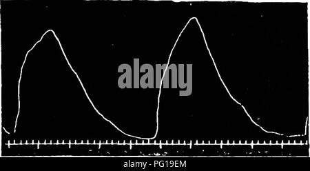 . Clinical diagnostics of the internal diseases of domestic animals. Veterinary medicine; Diagnosis, Veterinary; Veterinary medicine. RESPIRATORY APPARATUS. 95 Fig. 28a.. Normal Respiration Curve. Fig. 28b.. Please note that these images are extracted from scanned page images that may have been digitally enhanced for readability - coloration and appearance of these illustrations may not perfectly resemble the original work.. Malkmus, Bernhard, 1859-1925. Chicago, A. Eger Stock Photo