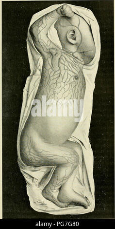 'Recherche et diagnostic de l'hérédo-syphilis tardive' (1907) Stock Photo