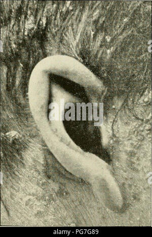 'Recherche et diagnostic de l'hérédo-syphilis tardive' (1907) Stock Photo