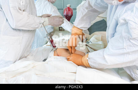 bone marrow transplant operation Stock Photo