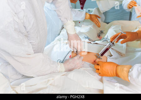 bone marrow transplant operation Stock Photo