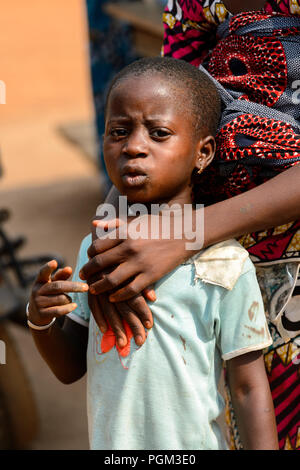 BOHICON, BENIN - JAN 12, 2017: Unidentified Beninese little girl is hugged by her mother at the local market. Benin children suffer of poverty due to  Stock Photo