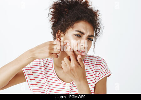 Close-up shot of intense upset woman bending towards camera and squeezing acne with index fingers on cheek, frowning, trying to get out pimple, being sad with bad facial condition right before date Stock Photo