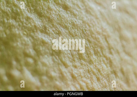 Close up view of cold urticaria allergic rash. Symptoms of itchy urticaria. Stock Photo