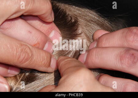 Head lice infection common in young people. Hair being checked using a special head lice comb. Stock Photo