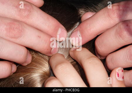 Head lice infection common in young people. Hair being checked using a special head lice comb. Stock Photo