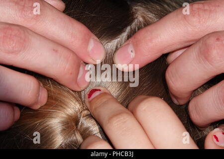 Head lice infection common in young people. Hair being checked using a special head lice comb. Stock Photo