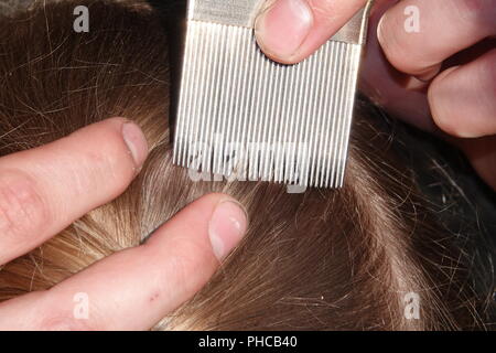 Head lice infection common in young people. Hair being checked using a ...