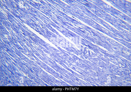 Microscopy photography. Cardiac muscle section. Stock Photo