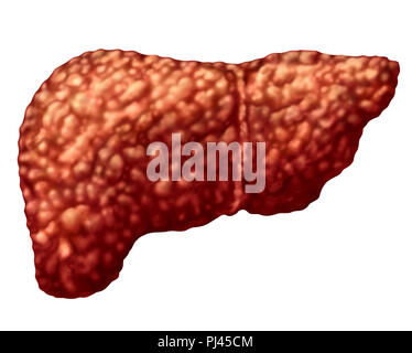 Fatty liver and hepatic steatosis body part isolated on white as a medical health care concept of the digestive system anatomy and vital organ. Stock Photo