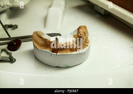 The plaster model of the jaws with tools. Dental prosthesis, dentures, prosthetics work. Dental technician in process of making dentures. Stock Photo