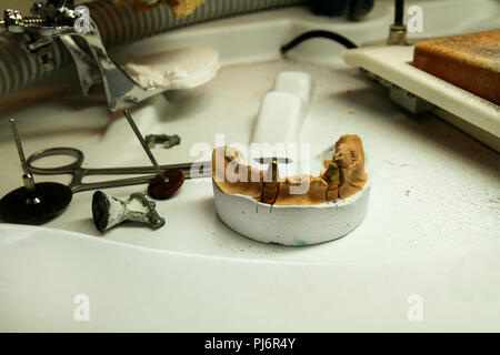 The plaster model of the jaws with tools. Dental prosthesis, dentures, prosthetics work. Dental technician in process of making dentures. Stock Photo