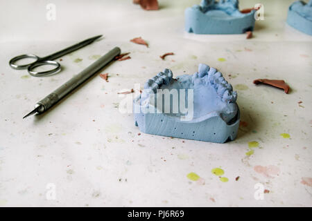 The plaster model of the jaws. Dental prosthesis, dentures, prosthetics work. Dental technician in process of making dentures. The plaster model. Stock Photo