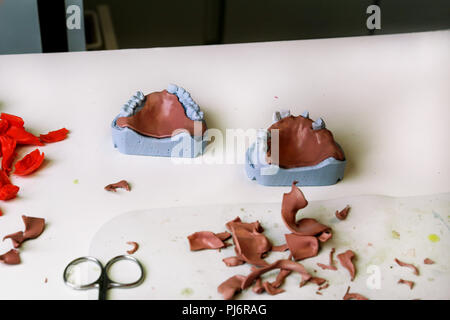 Process of making acrylic dental prosthetics. Dental prosthesis, dentures, prosthetics work. Dental technician in process of making dentures. Process. Stock Photo