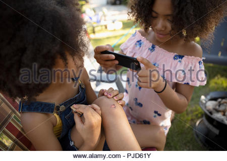 Girl scraped her knee Stock Photo - Alamy