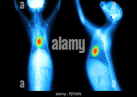 Radiography nodule x-ray detects major dog chest abnormalities with artificial intelligence (AI) detection technology. Smart medical , healthcare imag Stock Photo