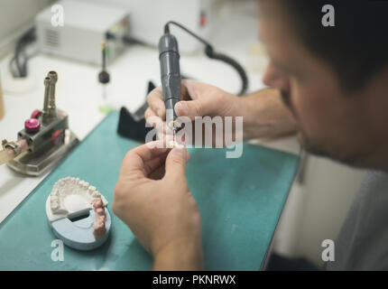 Artificial tooth and dental prosthesis being made. Stock Photo