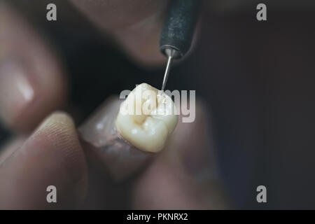 Artificial tooth being made. Stock Photo