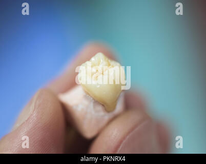 Artificial tooth being made. Stock Photo