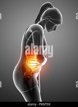 Woman with abdominal pain, computer illustration. Stock Photo