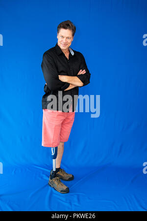 Middle-aged man with physical, leaning on his prosthesis. Stock Photo