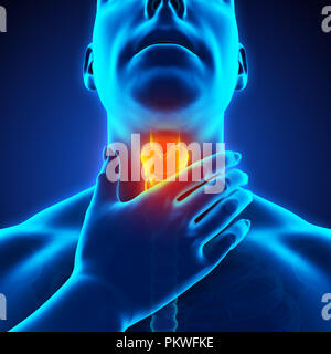 Sore Throat Illustration Stock Photo - Alamy