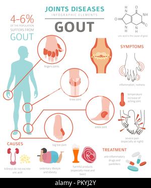 vector medical illustration of the symptoms of gout Stock Vector Image ...