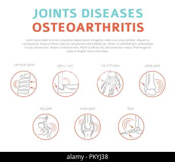 Joints diseases. Arthritis, osteoarthritis symptoms, treatment icon set ...