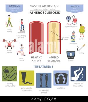 Vascular diseases. Atherosclerosis symptoms, treatment icon set. Medical infographic design. Vector illustration Stock Vector