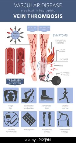 Vascular diseases. Vein thrombosis symptoms, treatment icon set. Medical infographic design. Vector illustration Stock Vector