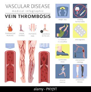 Vascular diseases. Vein thrombosis symptoms, treatment icon set. Medical infographic design. Vector illustration Stock Vector