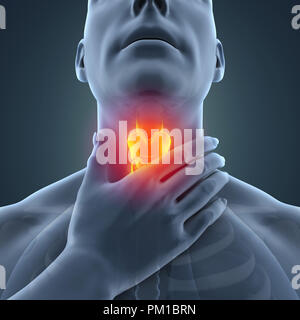 Sore Throat Illustration Stock Photo
