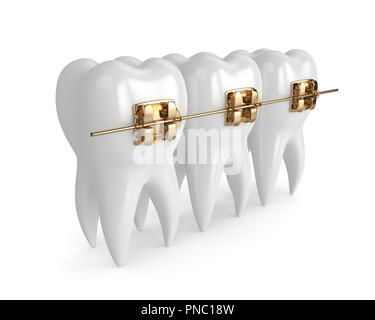 3d render of teeth with golden orthodontic braces isolated over white ...