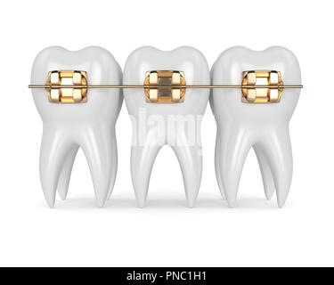 3d render of teeth with golden orthodontic braces isolated over white ...