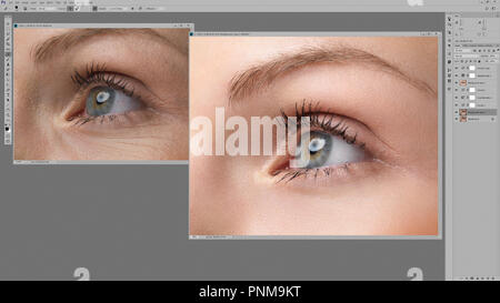 Womans eye original photo and one retouched with wrinkles and imperfections removed in Photoshop image editing software on computer screen. Before and Stock Photo