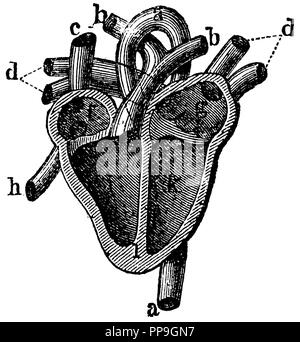 Human: section of the heart with the ascites a aorta, b pulmonary artery c superior vena cava d lunar veins f right anterior chamber g left anterior chamber h inferior vena cava i right ventricle k left ventricle l septum, anonym  1877 Stock Photo